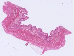 Urinary Bladder