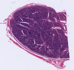 Submandibular Gland