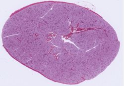 Sublingual Gland