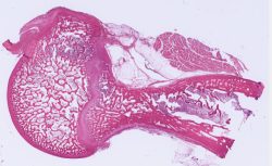 Endochondral Bone Formation, Tendon