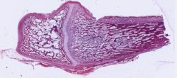 Endochondral Bone Formation