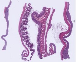 Rectum, Jejunum, Body of Stomach, Colon