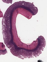 Ileum