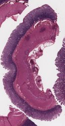 Ileum