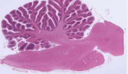 Cerebellum