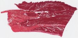 Muscle and Tendon / Muscle et tendon (H-E)