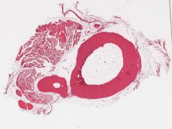 Femur (monkey; cross section) / Fémur (singe; coupe transversale) (H-E)