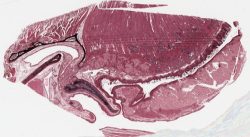 Pharynx-Larynx / Pharynx-Larynx (Verhoff)