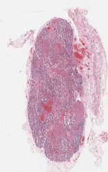 Parathyroid gland / Glande parathyroïde (H-E)