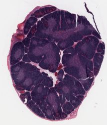 Thymus / Thymus (H-E)