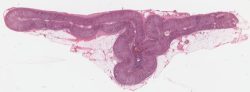 Adrenal gland / Glande surrénale (H-E)