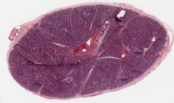 Submaxillary gland (submandibular) / Glande submandibulaire (H-E)