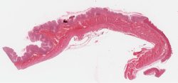 Oesophagus-cardiac Junction / Jonction de l’œsophage et du cardia (H-E)