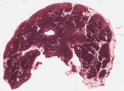 Pancreas / Pancréas (Verhoff)